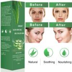Aloe Vera Gel - 100% Bio für Gesicht, Haare und Körper – Bild 6