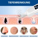 Aoyool Skin Scrubber Ultraschall Peeling | Porenreiniger | Mitesserentferner | Akne-Entferner – Bild 2
