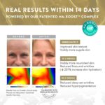 Hyaluronsäure Serum - 100% reine Anti-Aging & Anti-Falten Creme – Bild 2