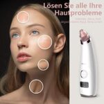 Mosen super Porenreiniger | Mitesserentferner mit Wärmegenerator – Bild 3
