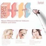 Mosen super Porenreiniger | Mitesserentferner mit Wärmegenerator – Bild 6