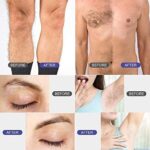 iFanze Wachswärmer Haarentfernung Waxing Set – Bild 8