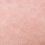 Einfache Haarentfernung für Zuhause mit Zuckerpaste – Bild 7