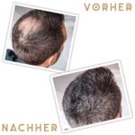 JP Confidence - Volles Haar in Sekunden – Bild 2