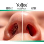 Yoffee Nose Wax Haarentfernung – Zubehör & Sets – Bild 4
