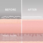 HoMedics Radiance Microdermabrasion,   Tiefes Hautpeeling, Schnelle Behandlung für normale und sensible Haut, Falten verringern, Haut belebend - HoMedics REMOVE Mikrodermabrasion mit kühlender Hautpflege, stellt jugendliche Ausstrahlung wieder her, glättet Falten und verbessert Hautton und Textur im Gesicht – Bild 7