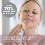 HoMedics Radiance Microdermabrasion,   Tiefes Hautpeeling, Schnelle Behandlung für normale und sensible Haut, Falten verringern, Haut belebend - HoMedics REMOVE Mikrodermabrasion mit kühlender Hautpflege, stellt jugendliche Ausstrahlung wieder her, glättet Falten und verbessert Hautton und Textur im Gesicht – Bild 2