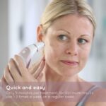 HoMedics Radiance Microdermabrasion,   Tiefes Hautpeeling, Schnelle Behandlung für normale und sensible Haut, Falten verringern, Haut belebend - HoMedics REMOVE Mikrodermabrasion mit kühlender Hautpflege, stellt jugendliche Ausstrahlung wieder her, glättet Falten und verbessert Hautton und Textur im Gesicht – Bild 4
