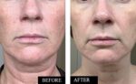 Kleem Organics | BIO Vitamin C Serum Gesicht mit Hyaluronsäure – Bild 7