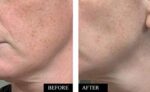 Kleem Organics | BIO Vitamin C Serum Gesicht mit Hyaluronsäure – Bild 8