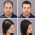 Toppik Haarfasern 3 g, Dunkelbraun, natürlich gewonnene Fasern aus Keratin für voller aussehendes Haar – Bild 12