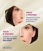 NIVEA Cellular Luminous 630 Anti-Pigmentflecken, aufhellendes Serum für einen ebenmässigen & strahlenden Teint, Gesichtspflege gegen Pigmentflecken – Bild 3