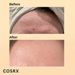 COSRX Snail 96 Essence – Feuchtigkeitsserum mit Schneckenschleim & Hyaluron für unreine & empfindliche Haut (100 ml) – Bild 4