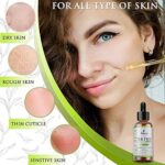 Kanzy Teebaumöl Bio Naturrein 60ml mit Pipette Kaltgepresst Tea Tree Oil für Gesicht, Haut, und Nagel Anti Pickel, Akne Öl, Acne Serum gegen Unreine Haut Ätherische Öle für Diffuser – Bild 3