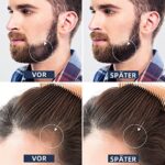 Bartroller 0,5 mm – Microneedling Derma Roller fuer Bart- & Haarpflege – Bild 4