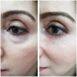 VITAYES Instant Ageback – Lifting-Creme mit Soforteffekt – Bild 3