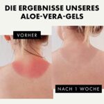 Eclat Skincare, Bio Aloe Vera Gel für Gesicht, Haare und Körper, 100% natürliches Bio Aloe Vera Gel für die Hautpflege nach der Sonne, beruhigend, feuchtigkeitsspendend, handgeerntet und kaltgepresst in Australien – Bild 3