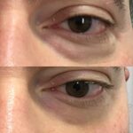 VITAYES Instant Ageback – Lifting-Creme mit Soforteffekt – Bild 6