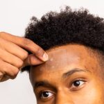 Avarelle Pickelpflaster (8 Stück) Absorbierende Hydrokolloid-Fleckenabdeckung mit Teebaumöl und Cica, vegan (Quadratisch / 8 Pflaster) – Bild 9