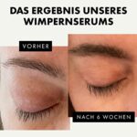 Eclat Skincare, Biologisches Wimpernwachstumsserum für längere, vollere, dichtere Wimpern, Schnelles Wimpernwachstumsserum & Brauenverstärker für natürliche Wimpern, Augenbrauen, Wimpernverlängerungen – Bild 3