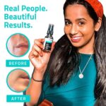 Reines Hyaluronsäure Serum für das Gesicht, Feuchtigkeitsspendendes Serum Gegen Falten, Trockene, Matte Haut & Dunkle Flecken, Anti-Aging-Pflege für Männer &Frauen, alle Hauttypen von YEOUTH – Bild 7