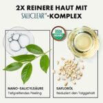Eclat Skincare, Akne Creme für fleckige Haut, Anti Blemish Gesichtscreme für Teenager, Frauen, Männer, Reduziert dunkle Flecken, Rötungen, Ausbrüche mit Vitamin C und Salycilsäure, Feuchtigkeitspflege bei Akne – Bild 4