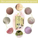 Akne Creme, Anti Pickel Creme, Körpercreme für Trockene Haut, Feuchtigkeitscreme, Unangenehme Haut – Bild 4