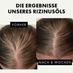 Eclat Skincare, Bio Rizinusöl für Wimpern, Augenbrauen, Haut, Haare, Nägel & Gesicht, Natural Oil Brow/Eyelash Growth Serum, Bestes Rizinusöl für Haarwachstum, Eye Lash Boost 1oz – Bild 3
