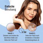 KASCIN Premium Pickel Patch Hydrocolloid - Made in Korea - Pimple Acne Patch Pflaster in vier Grössen – Bild 5