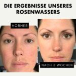 Eclat Skincare, Reines Rosenwasser für Gesicht, Haut & Haar, Bio-Rosenwasser Toner aus handgeernteten frischen bulgarischen Rosen für empfindliche Haut, Natürliches Gesichtswasser, nährend, feuchtigkeitsspendend – Bild 3