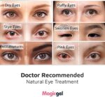 Magic Gel - Augenmaske zum Kühlen oder Erhitzen - Kühlende Augenmaske mit Kühlpads - Migräne Maske auch als Schlafmaske geeignet – Bild 5