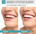 Unnis® Natürliche Kokosnuss Aktivkohle Pulver Zahnaufhellung für Weisse Zähne Bleaching Aktivkohle Zahnpasta Activated Charcoal powder Teeth Whitening – Bild 4