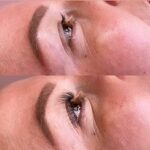 before after