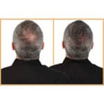 Kapilab Streuhaar Haarfasern Haarpuder zur Haarverdichtung - Keratin Ansatzpuder für Dünner Werdendes Haar Frauen und Männer Haarausfall 100% Natürlich – Bild 4
