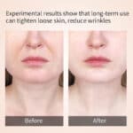 BEFORE & AFTER RESULTS