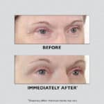 before and after creme