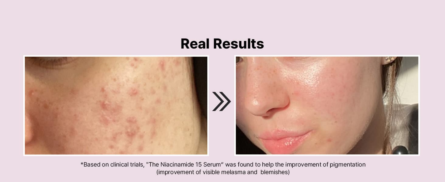 Real Results