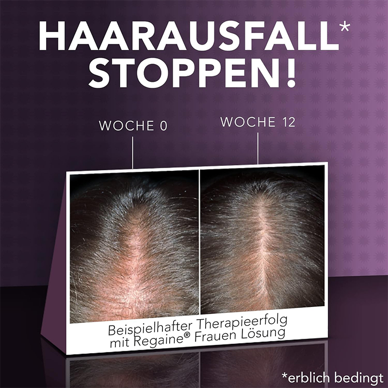 HAARAUSFALL STOPPEN!