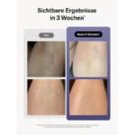 sichtbare ergebnisse in 3 wochen