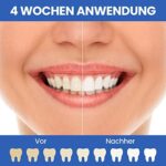 Oclean Flow Schallzahnbürste - 180 Tage Akku, 5 Modi, DuPont Kopf, Timer