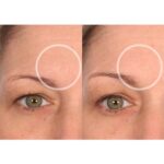 SiO Beauty FaceLift - Wiederverwendbare Anti-Falten-Pflaster für Hals, Stirn, Augen & Lächeln