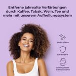 OnlySmile Zahnbleaching Set – Professionelles All-in-One Teeth Whitening Kit für sofort weisse Zähne