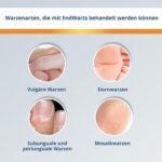 EndWarts CLASSIC Warzenlösung mit Ameisensäure – 3 ml für Hände und Füsse