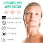 Hydrokolloid Pimple Patches mit Teebaumöl – Unsichtbar, Tag & Nacht, Wasserdicht & Atmungsaktiv
