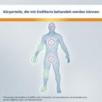 EndWarts CLASSIC Warzenlösung mit Ameisensäure – 3 ml für Hände und Füsse