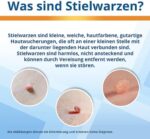 EndWarts EXTRA: Stielwarzen-Vereisung mit 9 Einweg-Spitzen und Pflastern – Für Hals, Brust & Achseln