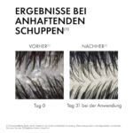 Vichy Dercos Anti-Schuppen Shampoo für normales bis fettiges Haar