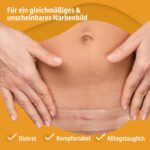 Evolsin® Silikon Narbenpflaster – Transparent, 200 cm – Bild 2