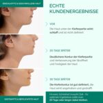 Plantifique V-Line Gesichtsmaske – 5er Set | Strafft Kinn & Jawline