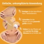 Evolsin® Silikon Narbenpflaster – Transparent, 200 cm – Bild 3
